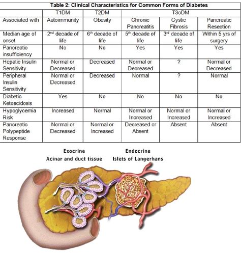 Figure 1 From Pancreatogenic Type 3c Diabetes Semantic Scholar