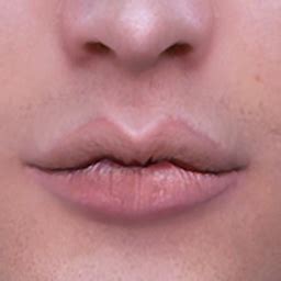 Install MALE LIPS PRESET 1 3 The Sims 4 Mods CurseForge