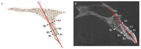 JCM Free Full Text Detailed Correlation Between Central Incisor