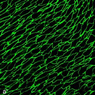 Double Label Confocal Laser Scanning Immunofluorescence Microscopy Of A