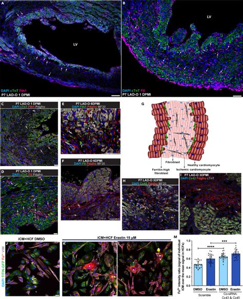 Cardiomyocyte Fibroblast Interaction Regulates Ferroptosis And Fibrosis