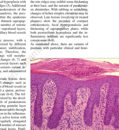 Parakeratosis Psoriasis