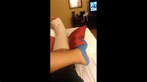 Achilles Tendonretrocalcaneal Bursitis Post Op Youtube