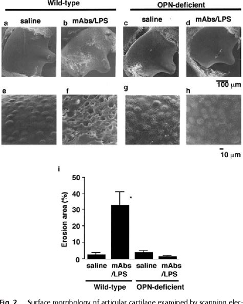 Figure From Osteopontin Deficiency Protects Joints Against