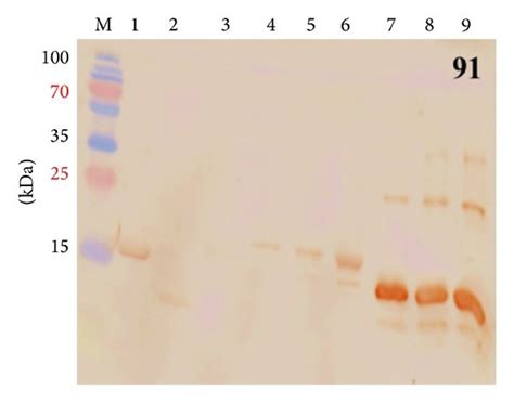 Antibody Responses Raised After Immunization Of Rabbits With