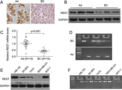 REST Expression Is Downregulated And Hypermethylated In Breast Cancer