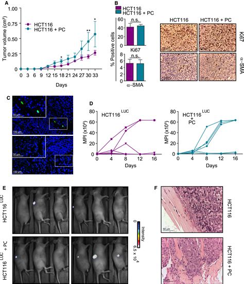 TGFβinduced IGFBP3 is a key paracrine factor from activated