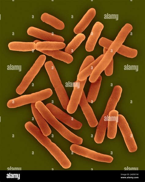 Coloured Scanning Electron Micrograph Sem Of E Coli Escherichia Coli Dividing