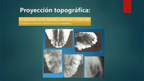 Tecnicas Radiograficas Intrabucales