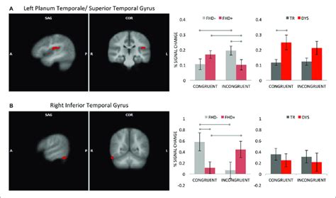 Interaction Effect Between Group And Multisensory Conditions