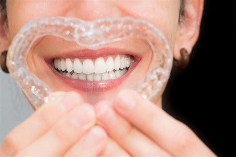 Beneficios De Ortodoncia Invisible Cl Nica Dental Mayor Reinosa