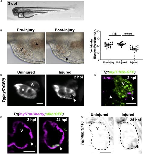 Frontiers Live Imaging Of Heart Injury In Larval Zebrafish Reveals A