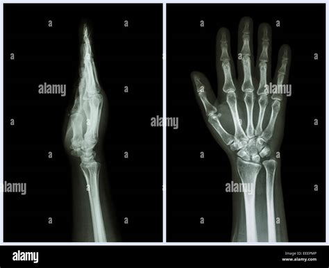 ray hands front side view normal human hands stock photo alamy