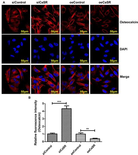 Frontiers Casr Induces Osteoclast Differentiation And Promotes Bone