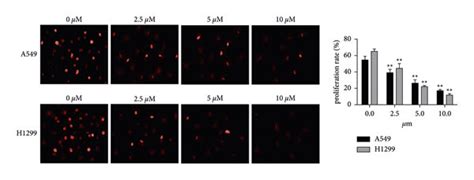 Z Ajoene Inhibits Cell Viability And Cell Proliferation In Nsclc Cells