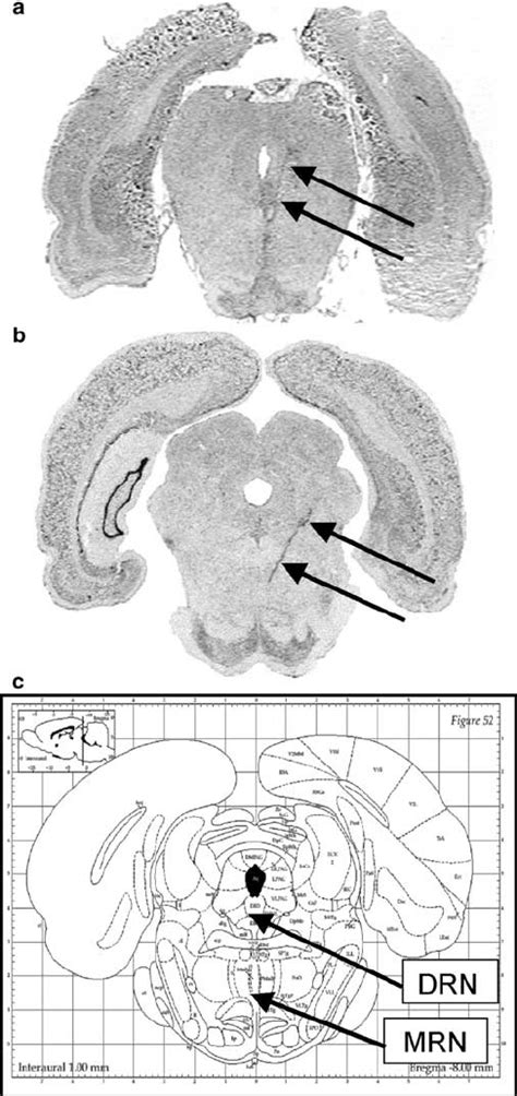 Time Course Of The Effects Of 5 7 DHT Lesions On Locomotor