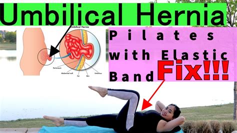 Core And Abdominal Exercises For Umbilical Hernia Diastasis Recti