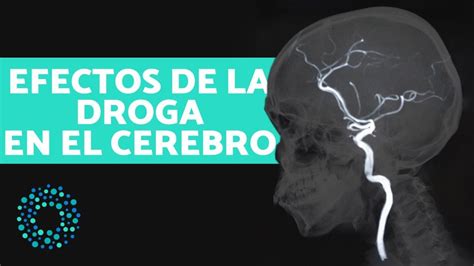 Cómo afectan las DROGAS al cerebro YouTube