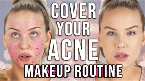 How To Cover Acne Scars Glass Skin Easy Youtube