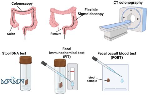 Cancers Free Full Text Early Onset Colorectal Cancer Current Insights