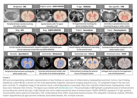 MedClub On Twitter RT CarlosJMoreno Neurology Review