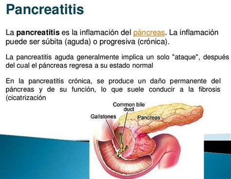 Pancreas Inflamado O Pancreatitis