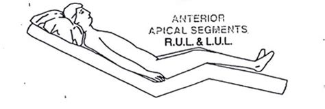 Postural Drainage Positions Flashcards Quizlet