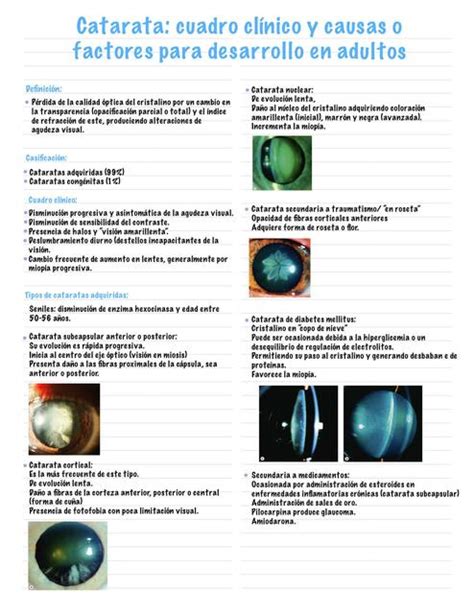 Cataratas Cuadro Clinico Y Causas Resumen IOVANNY CRUZ OJEDA UDocz