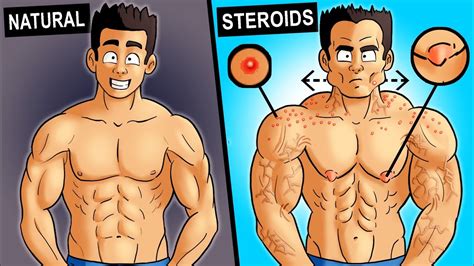 Steroids Vs Natural Pictures 17 Most Correct Answers Barkmanoil