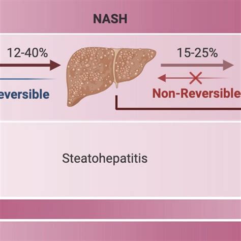 The NAFLD spectrum: stages and progression from healthy liver to HCC.... | Download Scientific ...