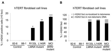 Detection Of γ H2ax Foci In Control And Lmna Mutant Fibroblasts