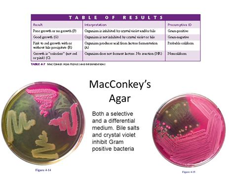 Macconkey Agar Composition Principle Uses And Procedure