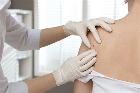 What To Expect During A Comprehensive Skin Exam Georgia Skin Specialists