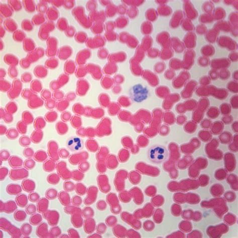 Human Blood Cell Under Microscope