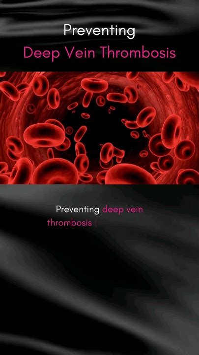 How To Prevent Deep Vein Thrombosis 💯🧠💪 Health Facts Life Shorts Youtube