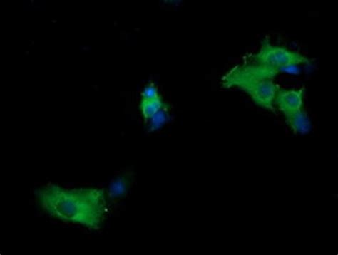 MAP2K1 Monoclonal Antibody OTI8H1 TrueMAB OriGene 100 μL