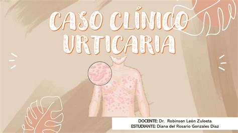 Urticaria DermatologÍa Esquemas Y Mapas Conceptuales De Dermatología