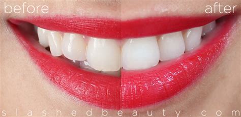 REVIEW with Before & After: Crest 3D White Whitestrips | Slashed Beauty