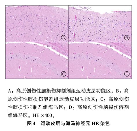 He Staining Of Motor Cortex And Hippocampal Neurons Download