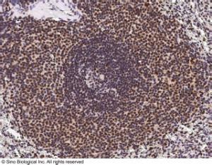 Anti ETV5 Rabbit Polyclonal Antibody VWR