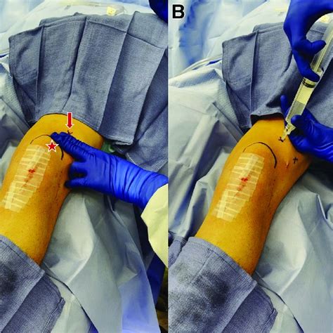 Clinical Figure Of The Left Knee With The Patient Positioned Supine And Download Scientific