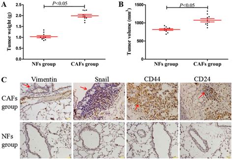 Cancerassociated Fibroblasts Induce Epithelialmesenchymal Transition