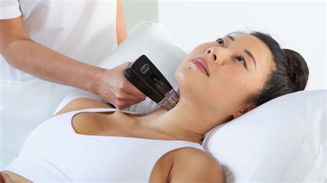 Morpheus8 Radiofrequency Microneedling Skin Rejuvenation Benefits