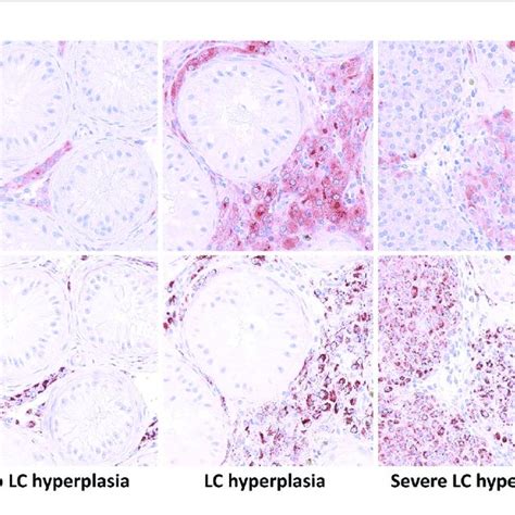 Expression Pattern Of Insulin Like Factor 3 Insl3 And Cytochrome