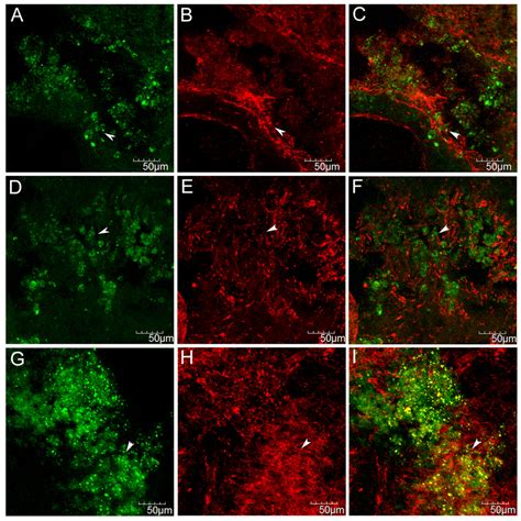 Immunofluorescence Staining For Nucleus And Mitotic Cell Antigen Numa