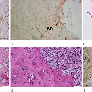 Representative Histological And Immunohistochemical Views In Different