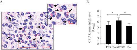 Figure From Identification Of A Novel Subset Of Myeloid Derived