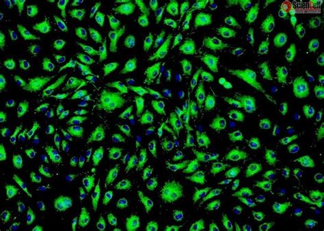 Human Primary Esophageal Microvascular Endothelial Cells Passage 1