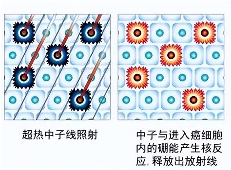 国产抗癌硼药问世，30分钟清除癌细胞仅需十万？预计明年可用！财经头条