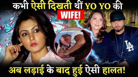 Yo Yo Honey Singh Wife Shalini Talwar How They Met And How A